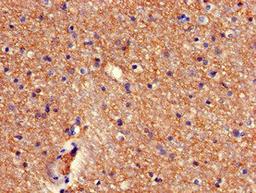 Immunohistochemistry of paraffin-embedded human brain tissue using CSB-PA880939LA01HU at dilution of 1:100