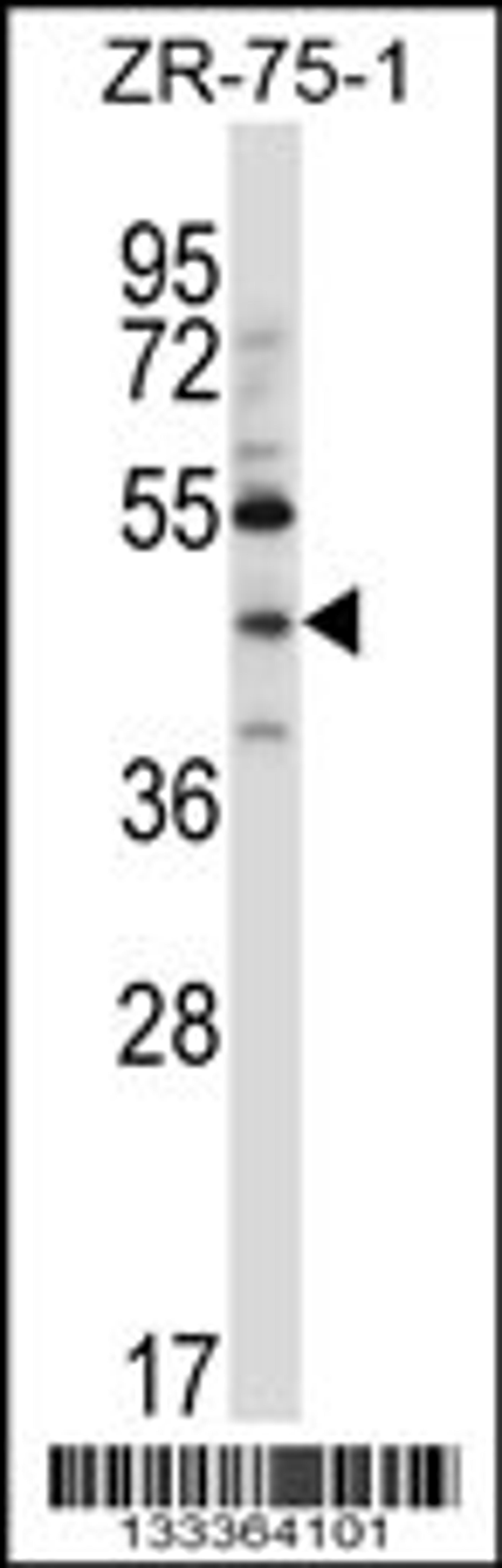 Western blot analysis in ZR-75-1 cell line lysates (35ug/lane).This demonstdetected the NEUROD6 protein (arrow).