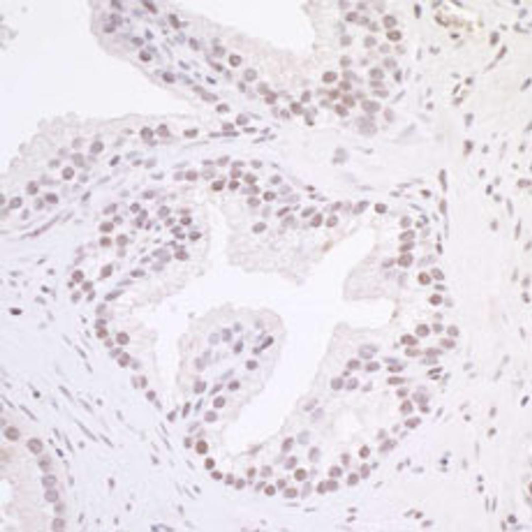 Detection of human MAZ/SAF-1 by immunohistochemistry.