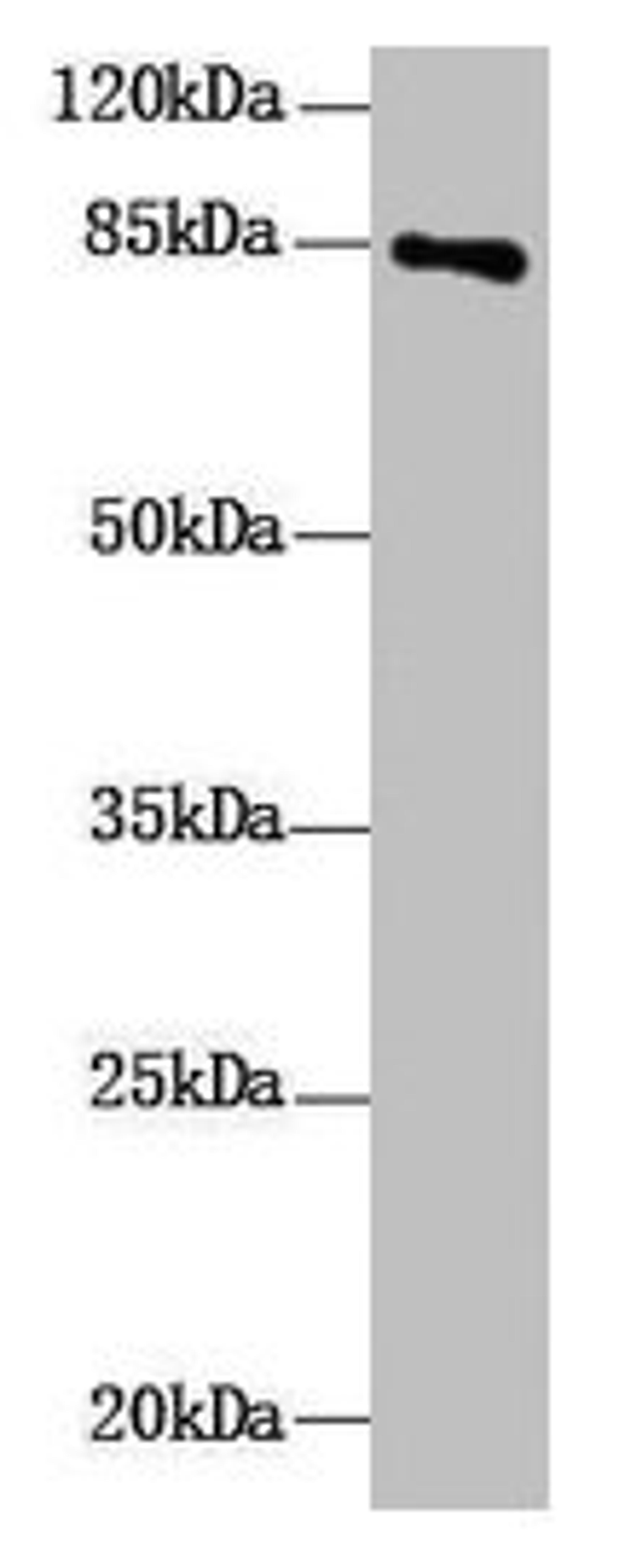 Western Blot. All lanes: DHX32 antibody at 10µg/ml + Mouse liver tissue. Secondary. Goat polyclonal to rabbit IgG at 1/10000 dilution. Predicted band size: 85, 76 kDa. Observed band size: 85 kDa