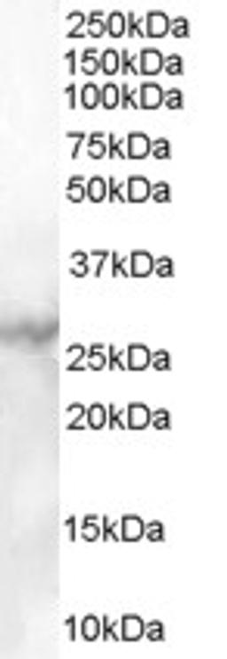 45-869 (1ug/ml) staining of Human Heart lysate (35ug protein in RIPA buffer). Primary incubation was 1 hour. Detected by chemiluminescence.