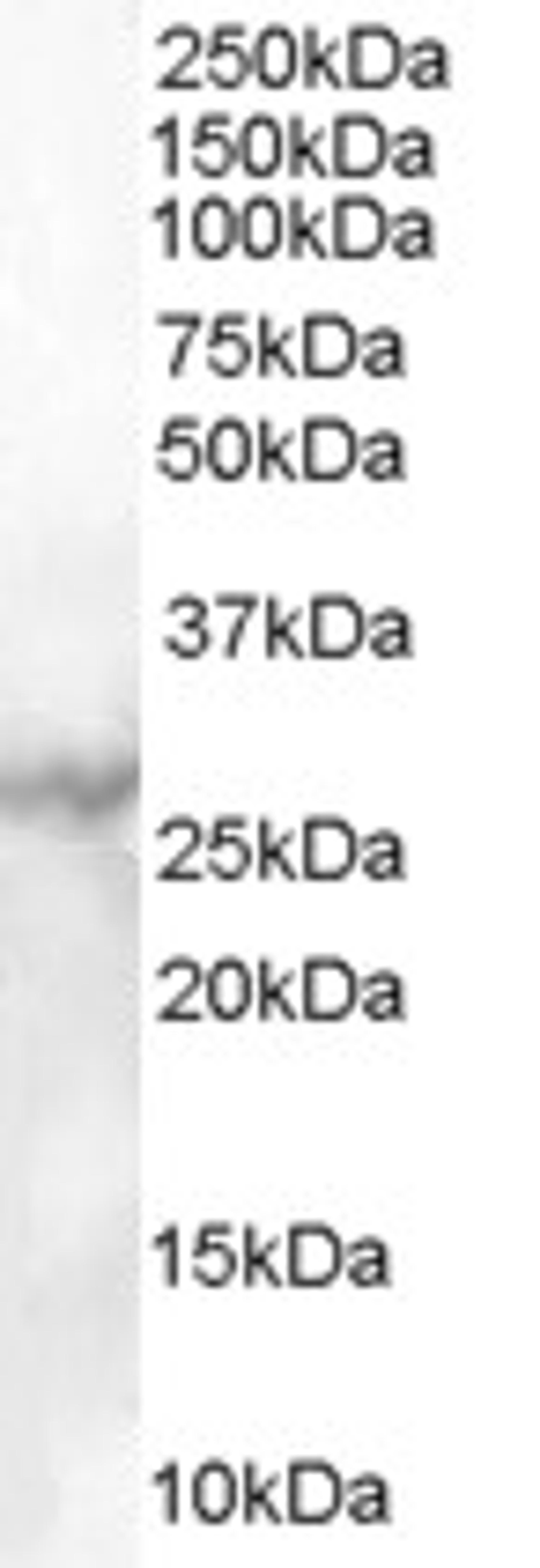 45-869 (1ug/ml) staining of Human Heart lysate (35ug protein in RIPA buffer). Primary incubation was 1 hour. Detected by chemiluminescence.