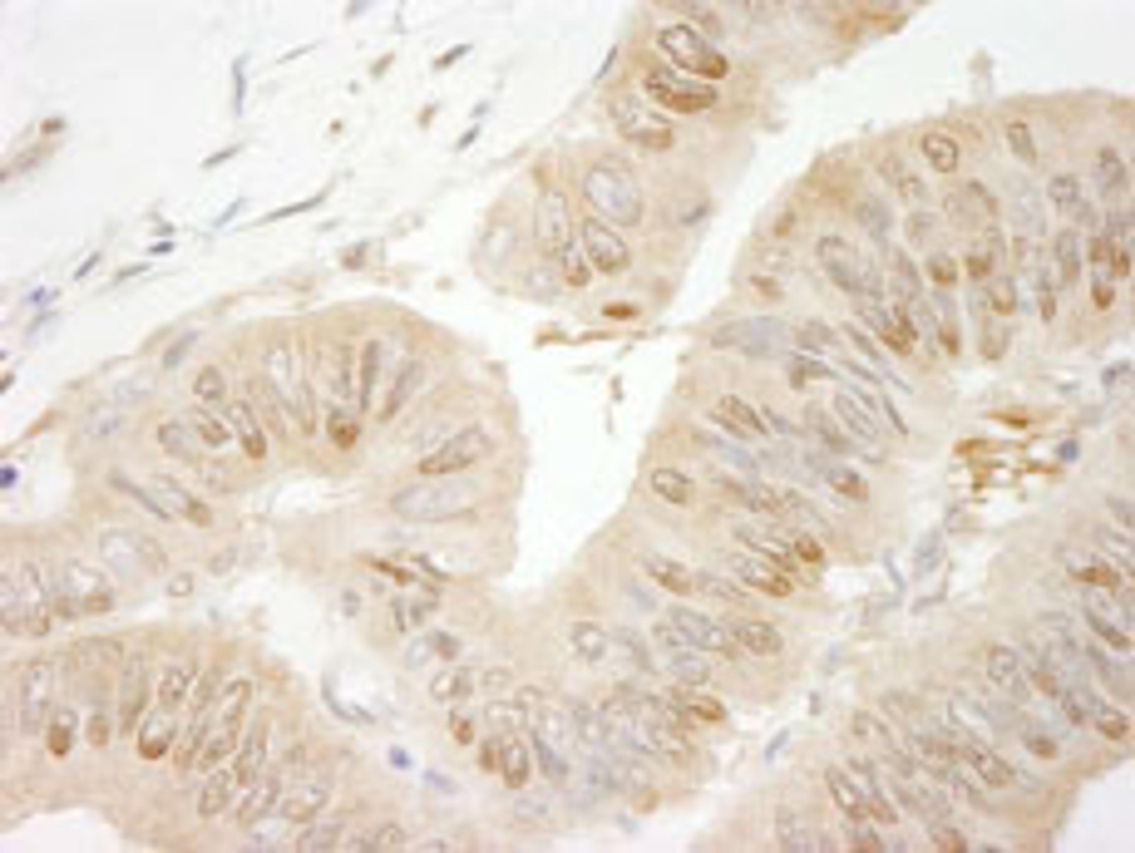 Detection of human RanBP1 by immunohistochemistry.