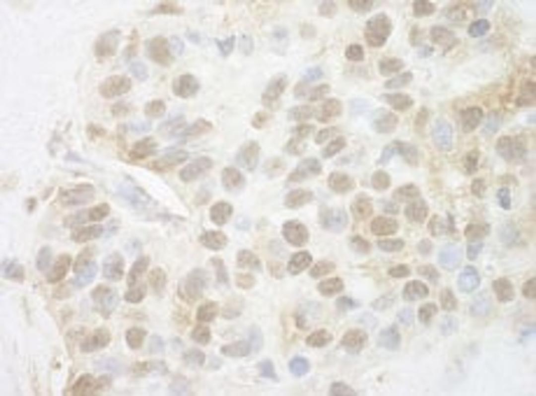 Detection of human Pygo2 by immunohistochemistry.