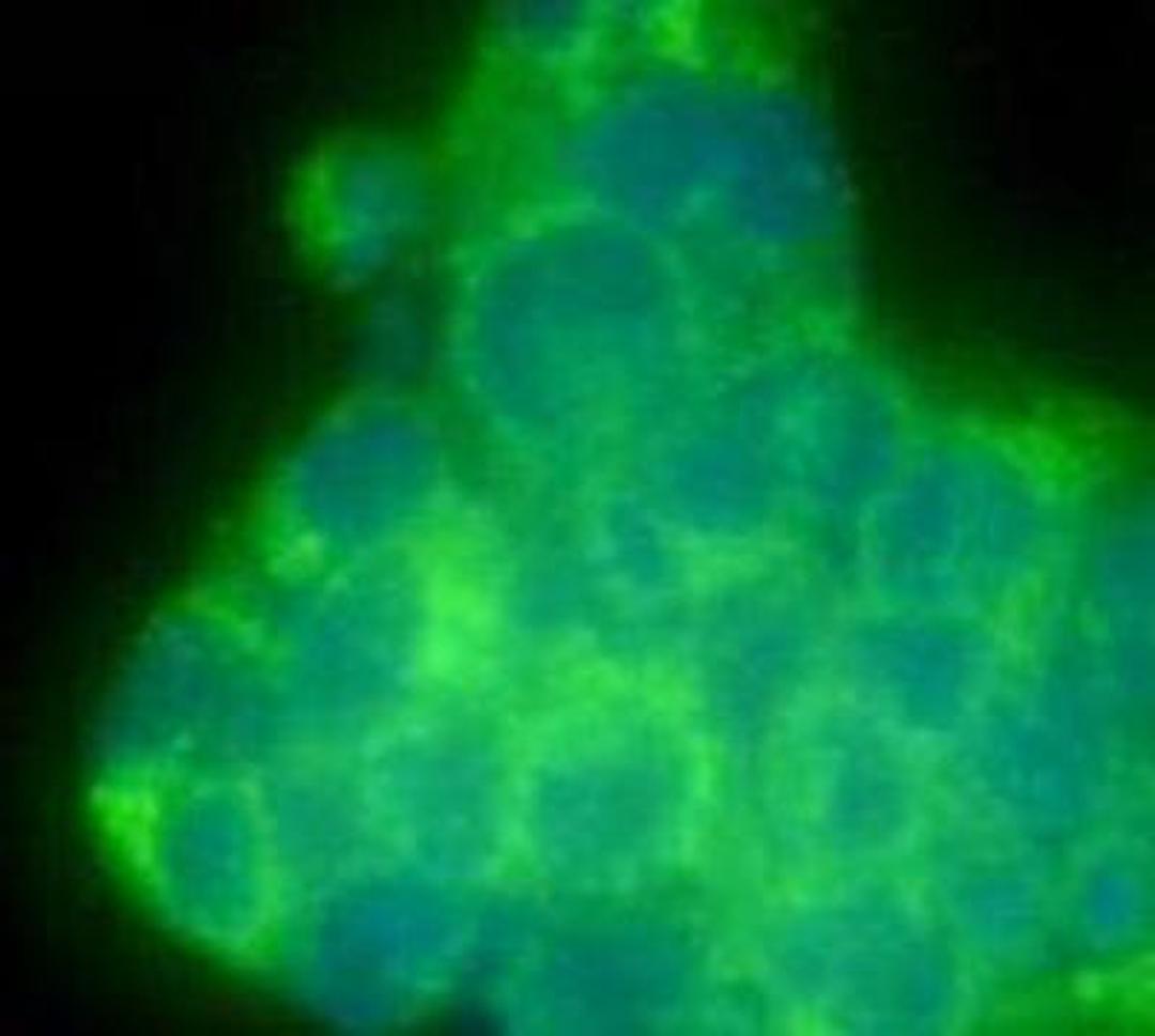 Immunofluorescence analysis of NCCIT cell using THY-1 antibody