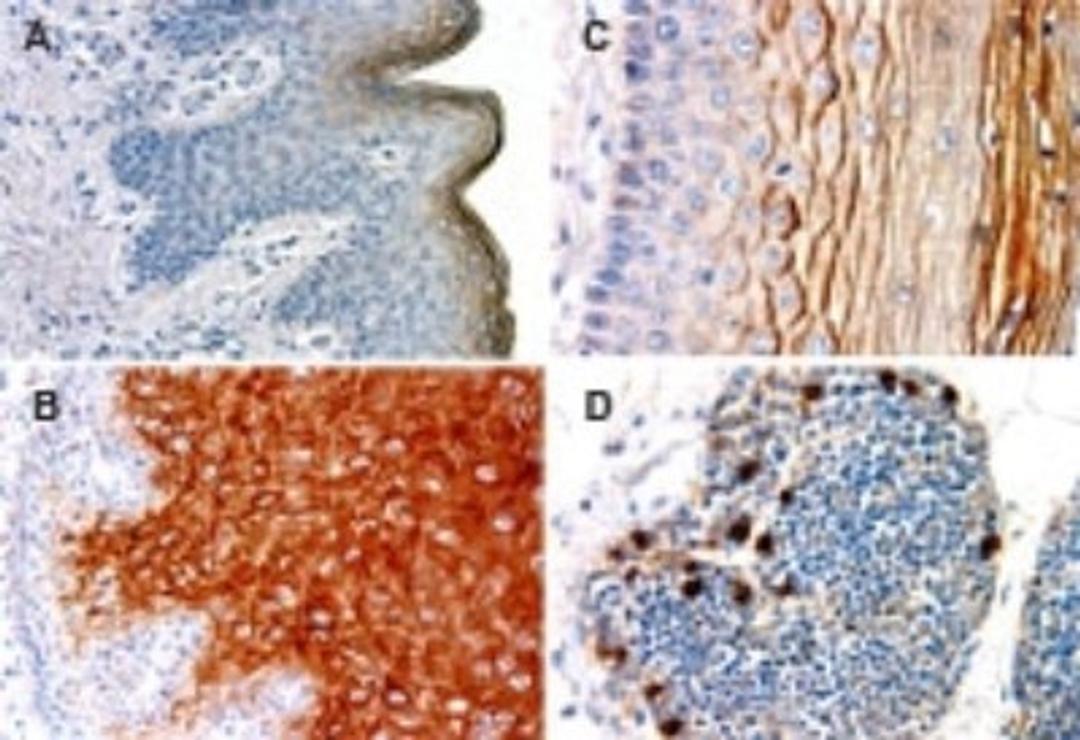 Immunohistochemistry-Paraffin: NALP1 Antibody [NB100-56148] - Formalin-fixed, paraffin-embedded normal human tissue sections stained for NALP1 (CARD7/NAC) using NB100-56148 at 1:2000. A, epidermis. B, esophagus. C, uterine cervix. D, thymus. Hematoxylin-eosin counterstain. In A-C, NALP1 expression is associated with differentiation in stratified epithelial of the skin, esophagus, and cervix.