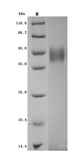 (Tris-Glycine gel) Discontinuous SDS-PAGE (reduced) with 5% enrichment gel and 15% separation gel.