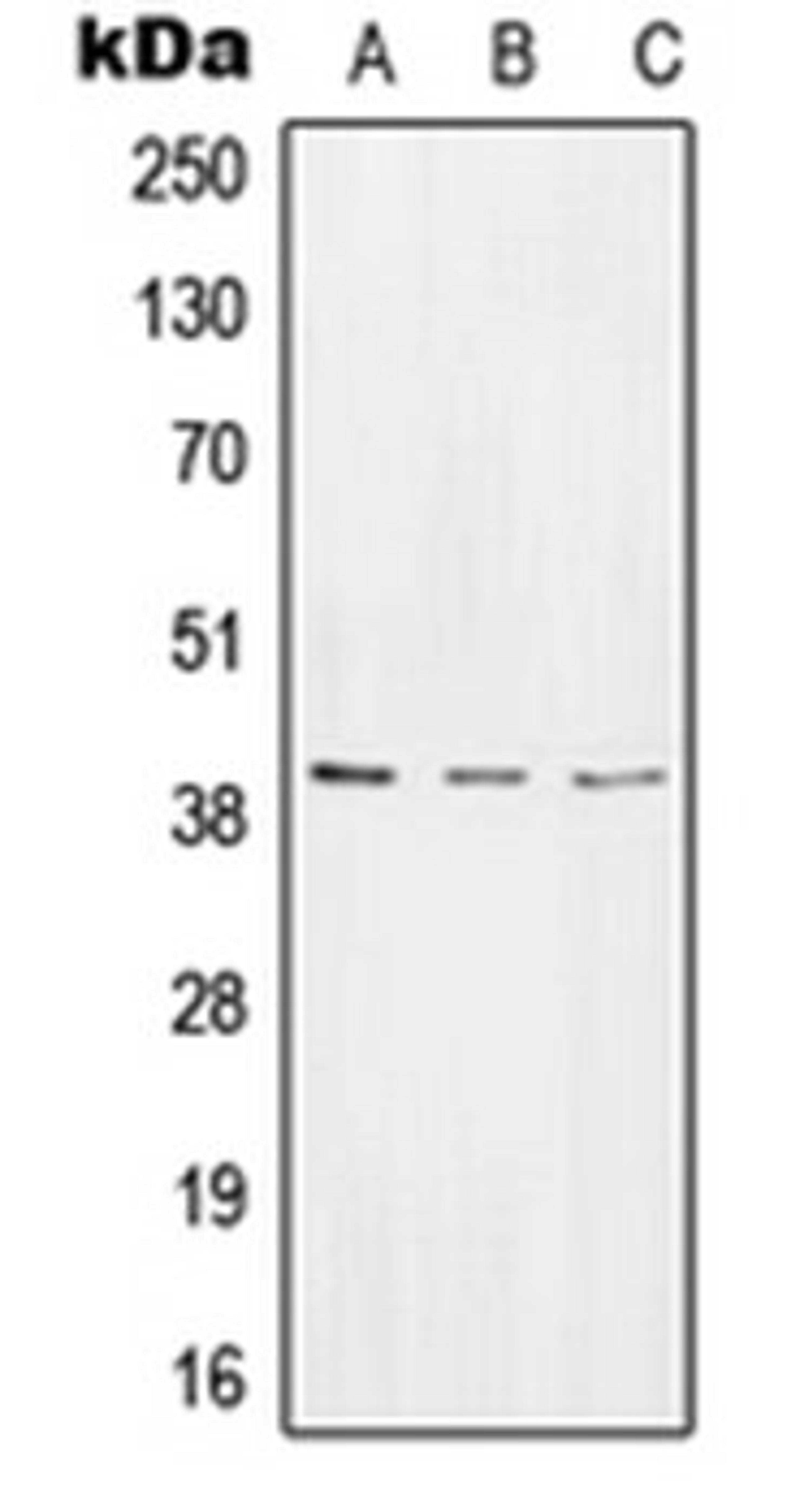 Western blot analysis of HeLa (Lane 1), NIH3T3 (Lane 2), rat stomach (Lane 3) whole cell lysates using RTCA antibody