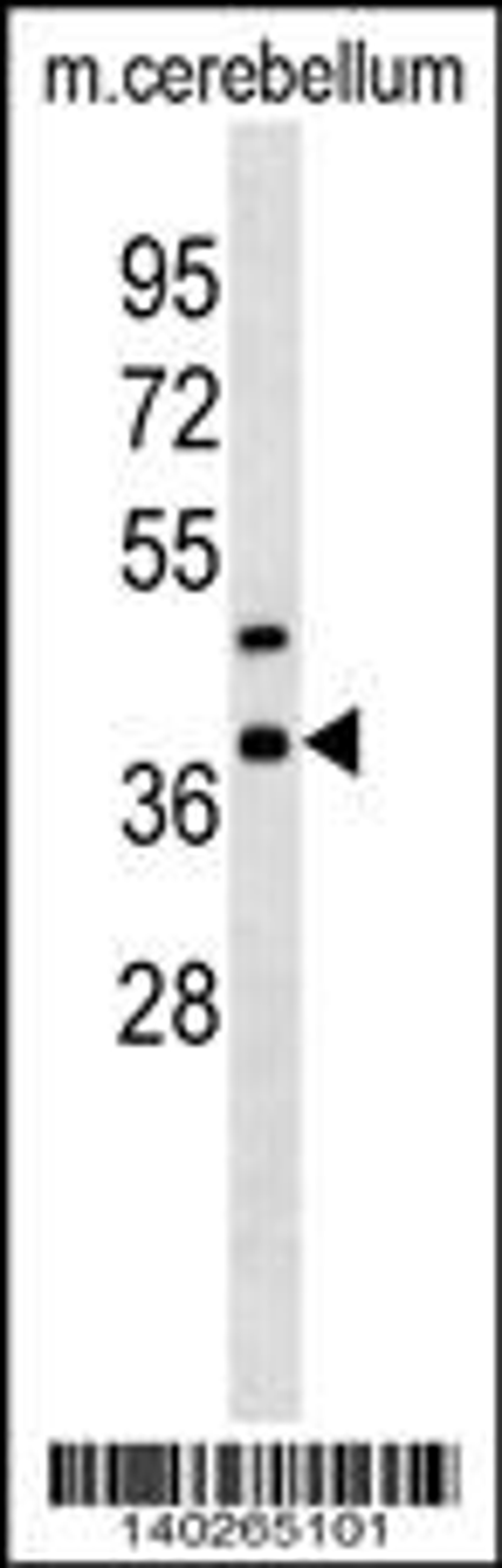 Western blot analysis in mouse cerebellum tissue lysates (35ug/lane).