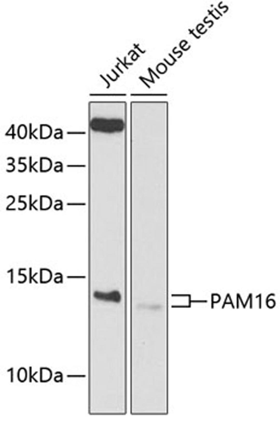 Western blot - PAM16 antibody (A9875)