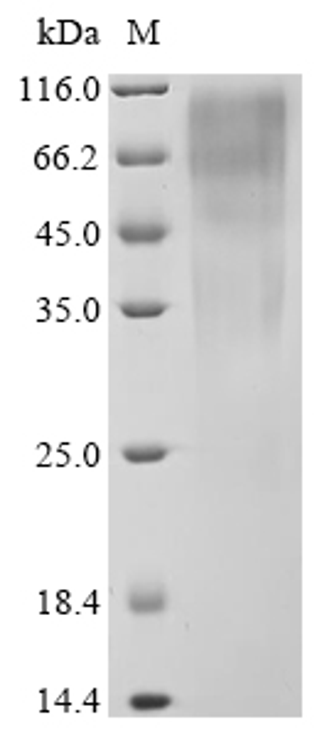 (Tris-Glycine gel) Discontinuous SDS-PAGE (reduced) with 5% enrichment gel and 15% separation gel.