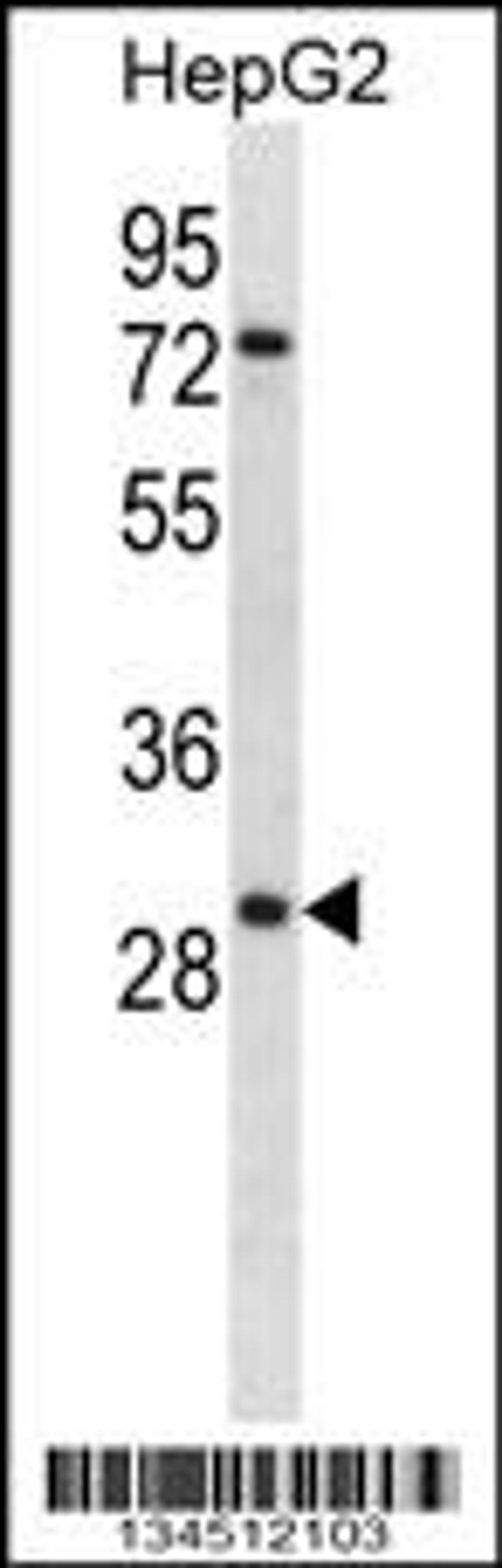 Western blot analysis in HepG2 cell line lysates (35ug/lane).