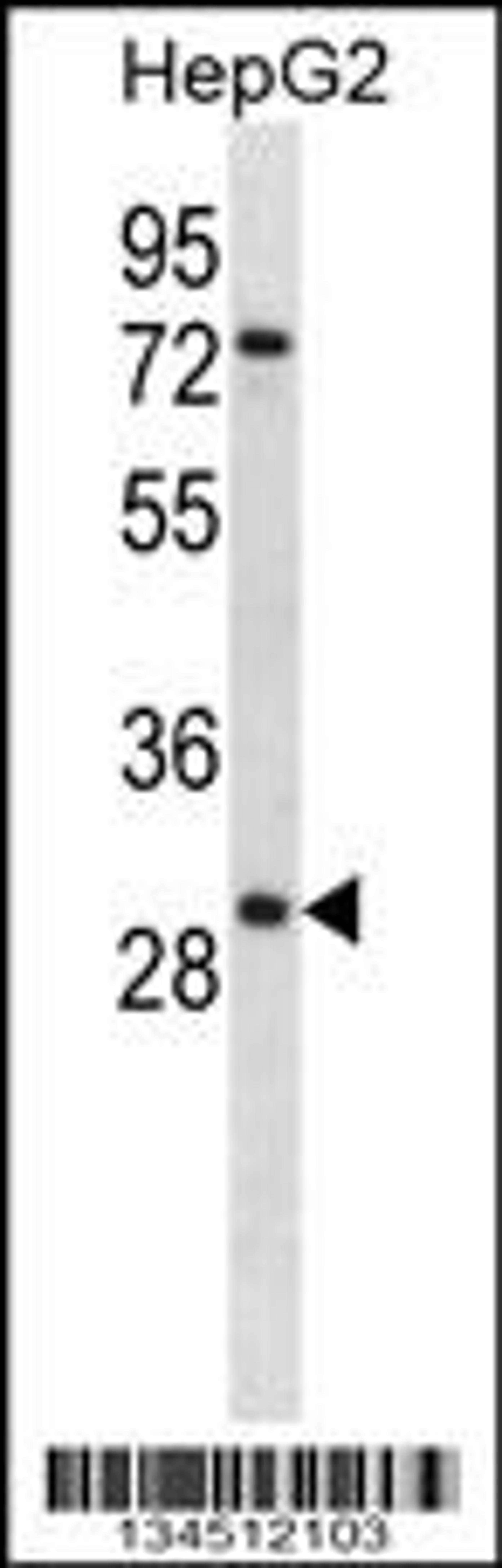 Western blot analysis in HepG2 cell line lysates (35ug/lane).