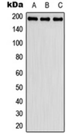 Western blot analysis of HeLa (Lane 1), SP2/0 (Lane 2), H9C2 (Lane 3) whole cell lysates using FBLN2 antibody