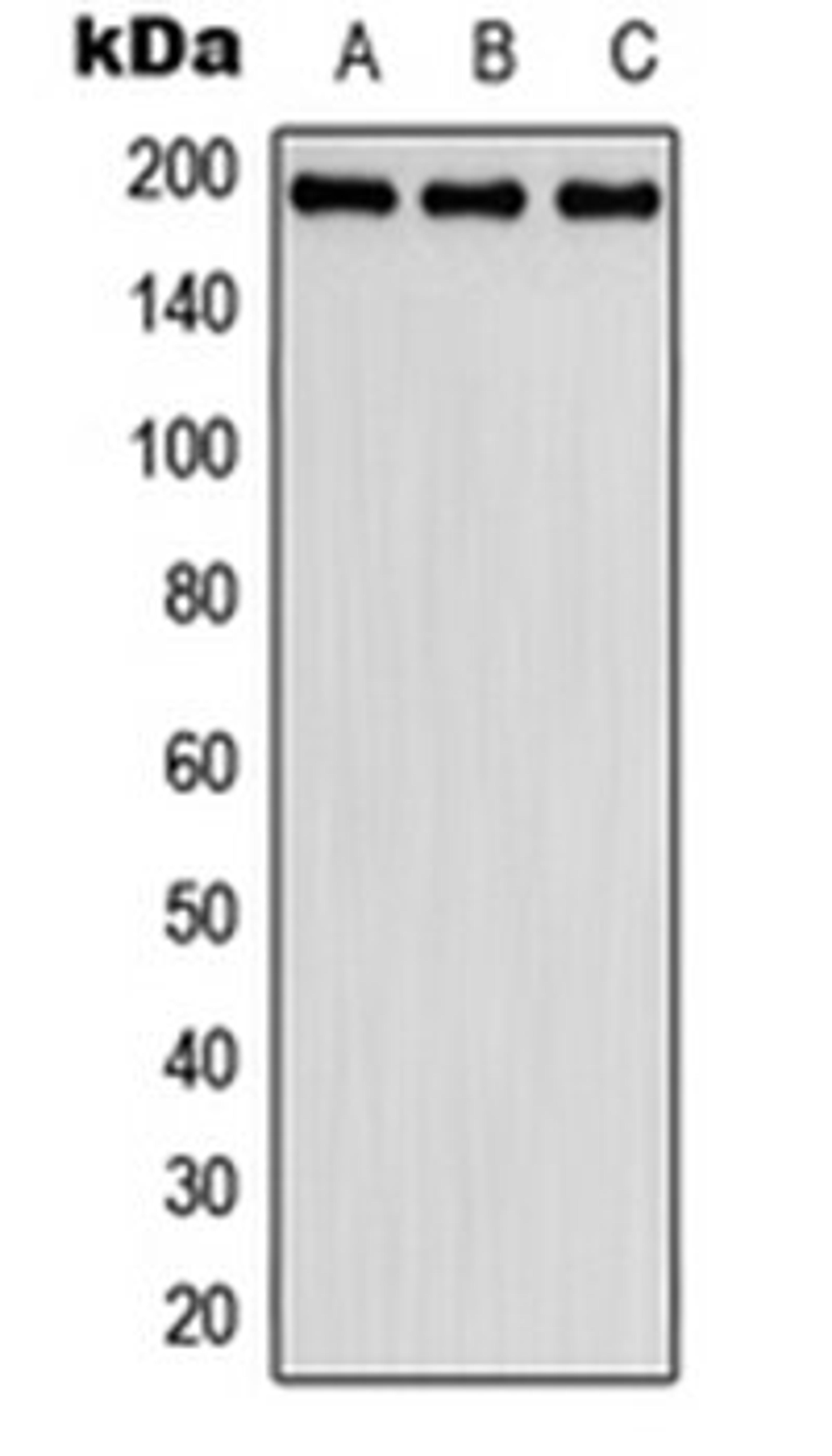 Western blot analysis of HeLa (Lane 1), SP2/0 (Lane 2), H9C2 (Lane 3) whole cell lysates using FBLN2 antibody