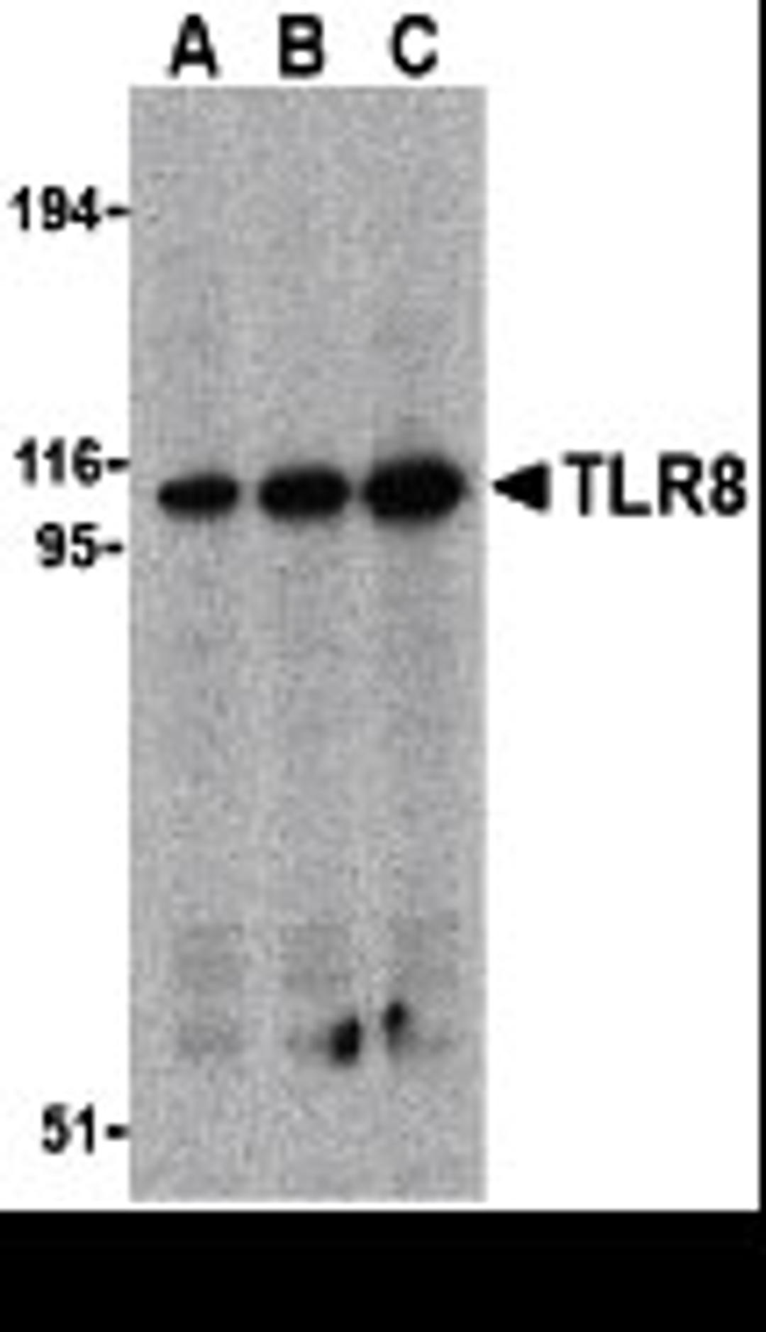 Western blot analysis of TLR8 in Daudi cell lysates with TLR8 antibody at (A) 0.5, (B) 1, and (C) 2 &#956;g/mL. 