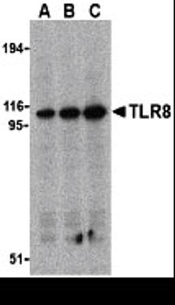 Western blot analysis of TLR8 in Daudi cell lysates with TLR8 antibody at (A) 0.5, (B) 1, and (C) 2 μg/mL.