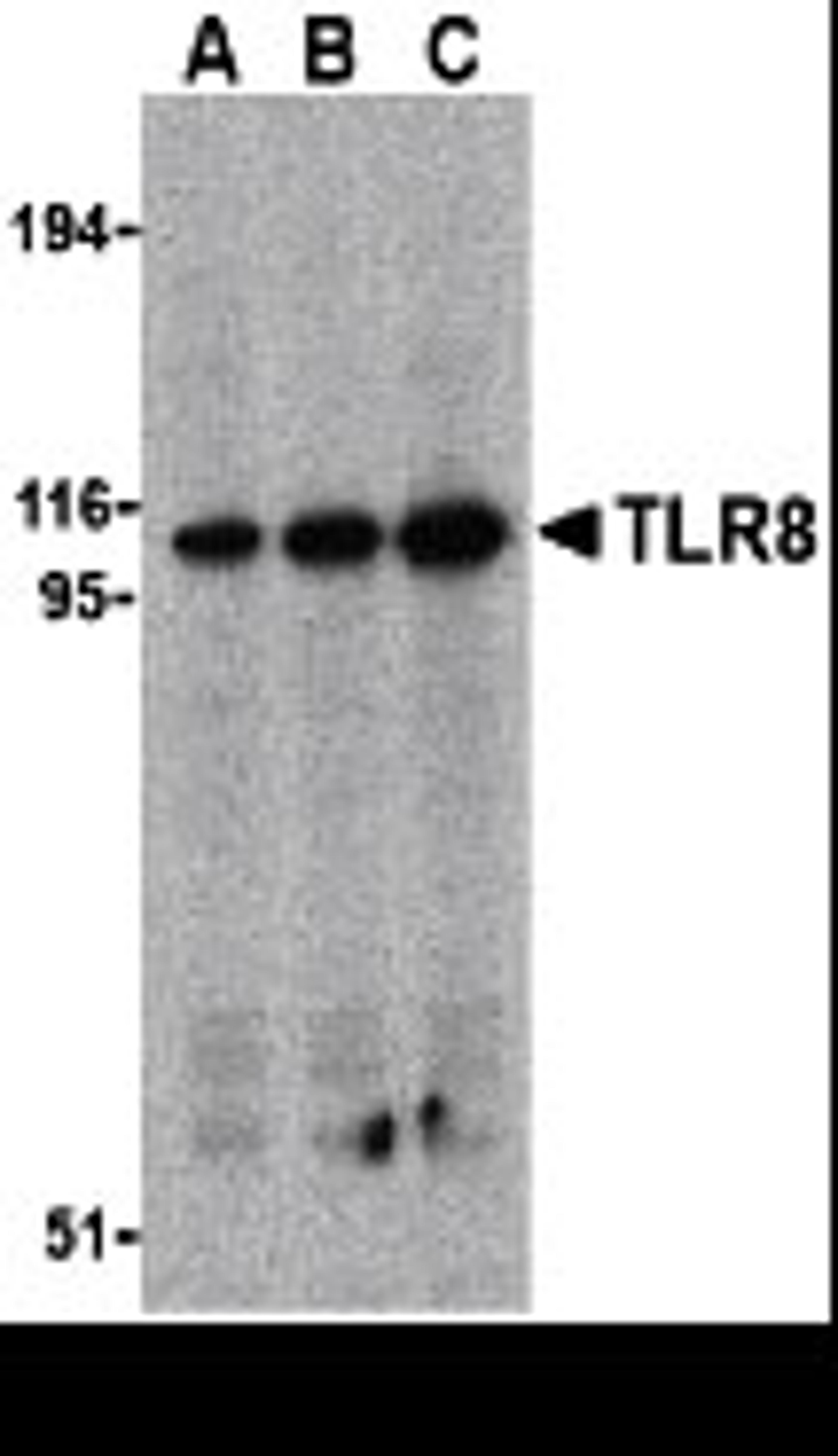 Western blot analysis of TLR8 in Daudi cell lysates with TLR8 antibody at (A) 0.5, (B) 1, and (C) 2 μg/mL.