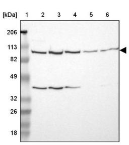 Western Blot: USP51 Antibody [NBP1-86167] - Lane 1: Marker [kDa] 206, 113, 82, 49, 32, 26, 18<br/>Lane 2: Human cell line RT-4<br/>Lane 3: Human cell line U-251MG sp<br/>Lane 4: Human cell line A-431<br/>Lane 5: Human liver tissue<br/>Lane 6: Human tonsil tissue