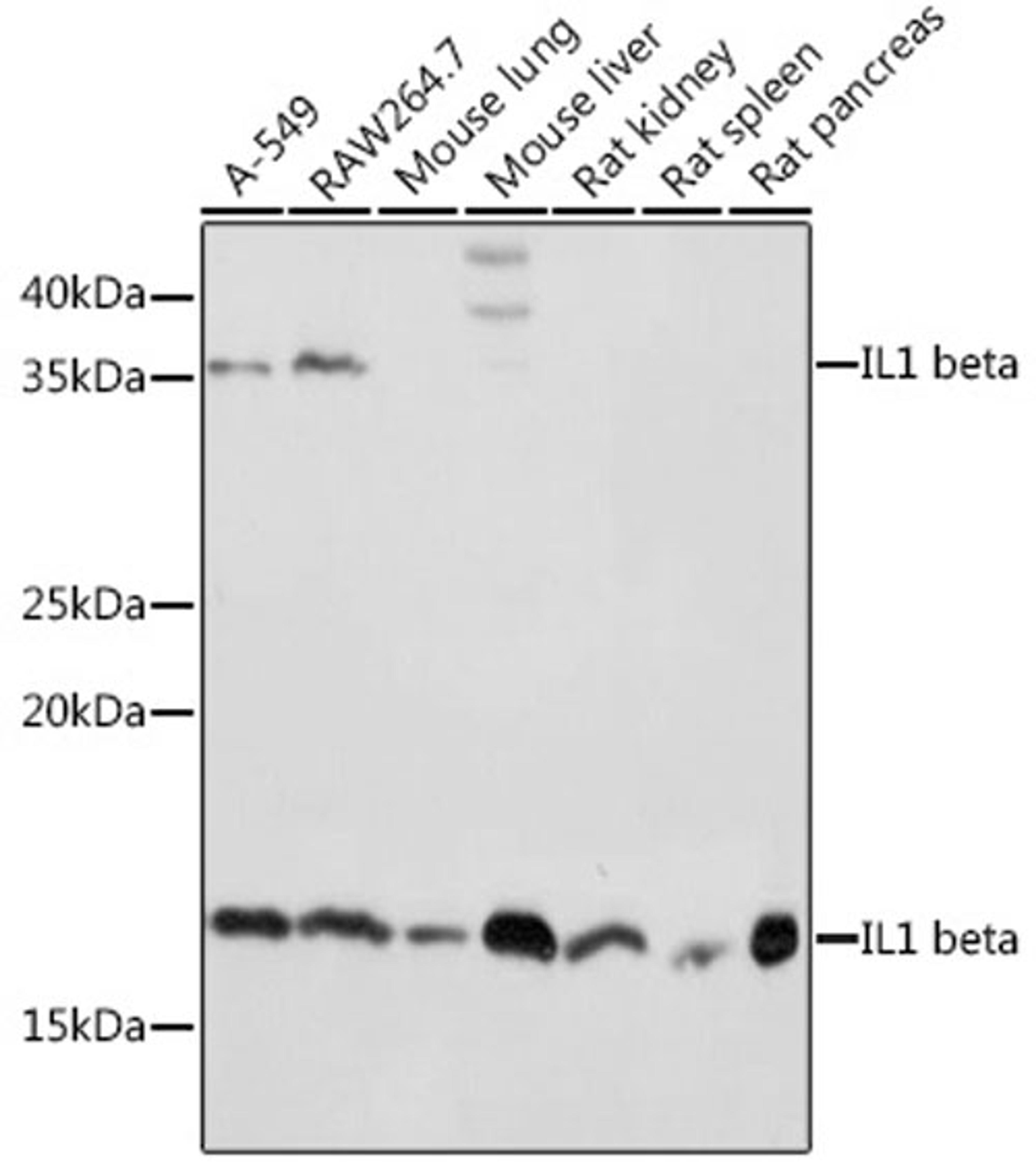 Western blot - IL1 beta antibody (A16288)