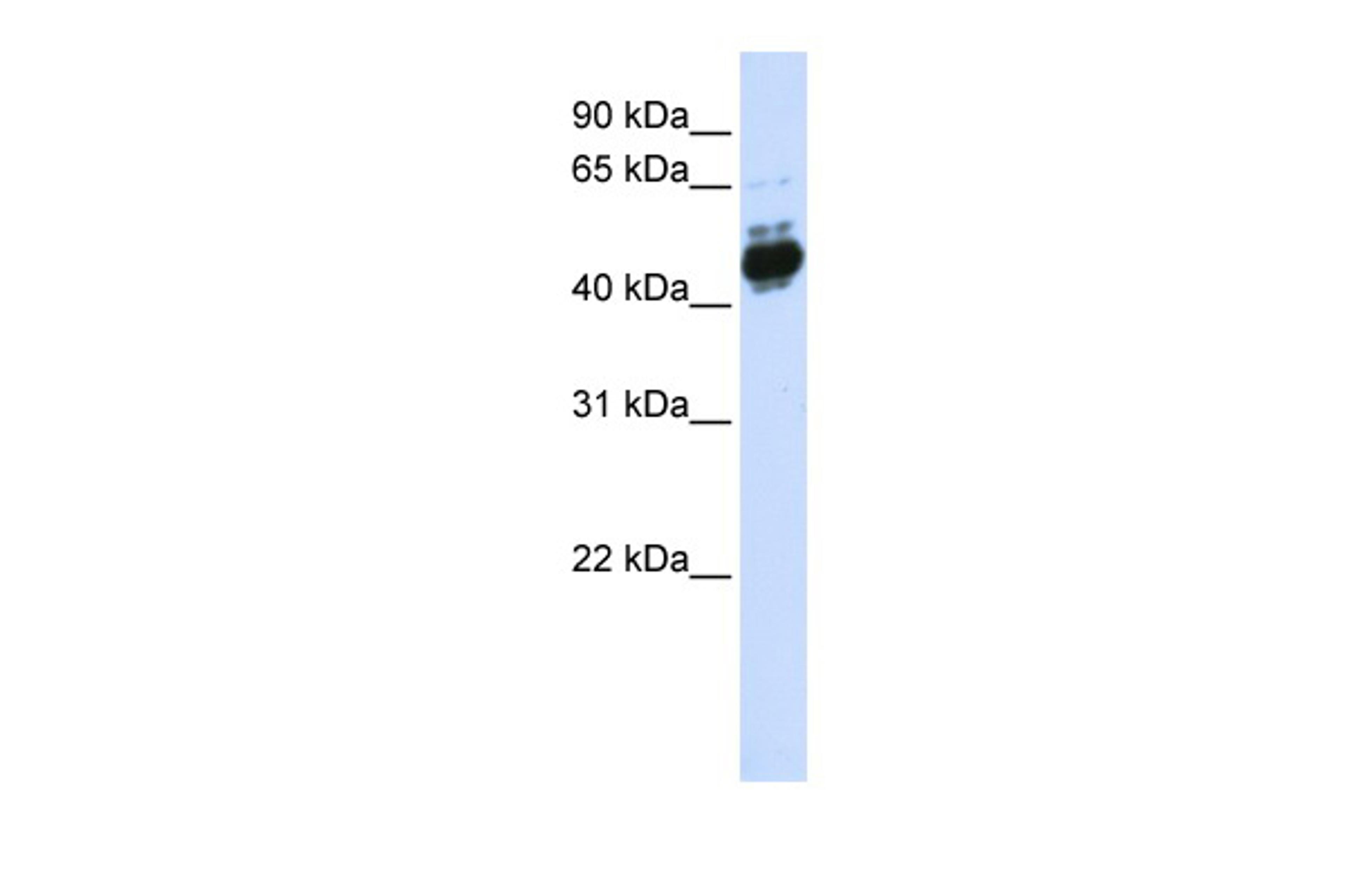 Antibody used in WB on Transfected 293T at 0.2-1 ug/ml.