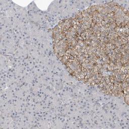 Immunohistochemistry-Paraffin: CACNB2 Antibody [NBP1-86680] - Staining of human pancreas shows moderate membranous positivity in islet cells.