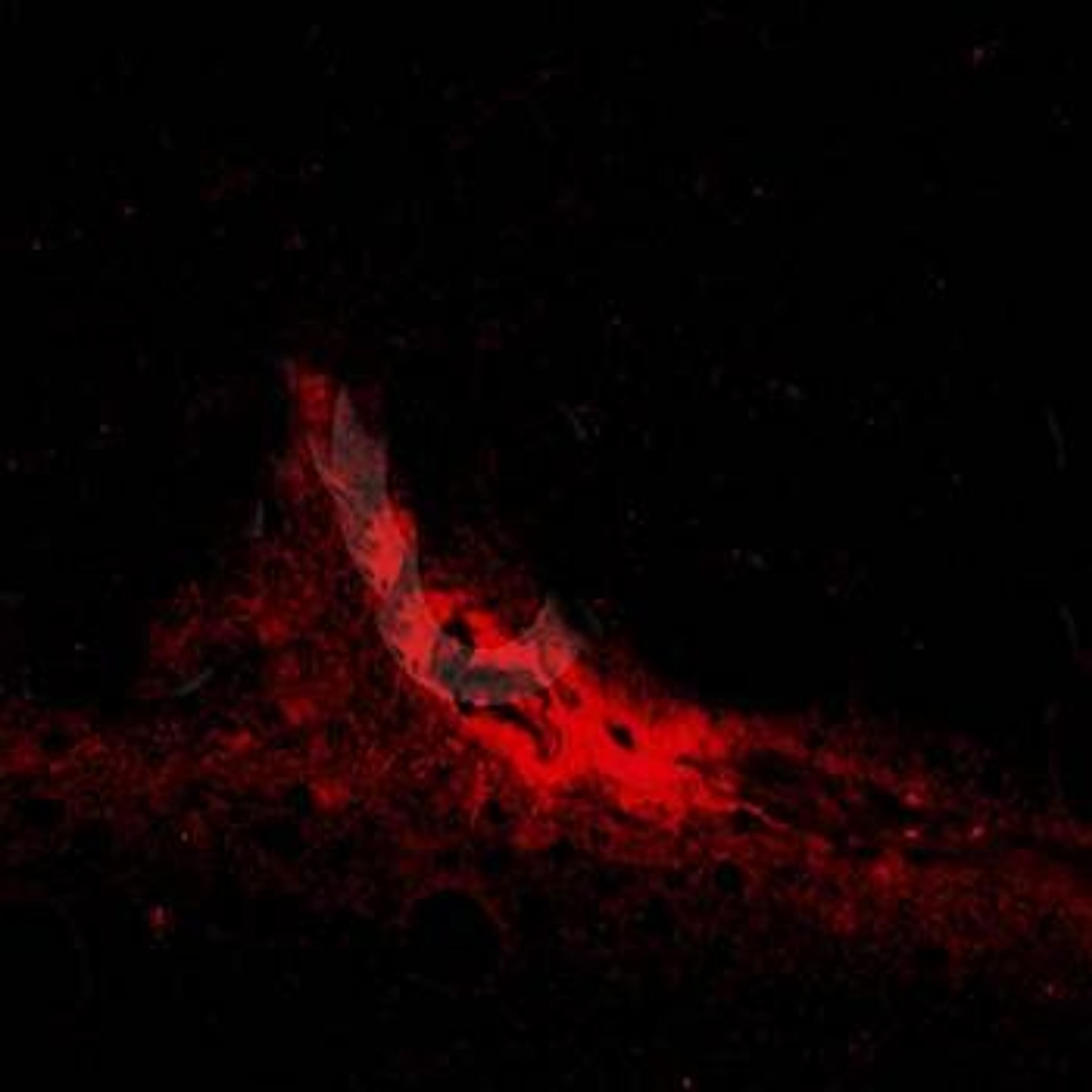 IHC-P of human brain tissue (dilution at:1:200) using AANAT antibody