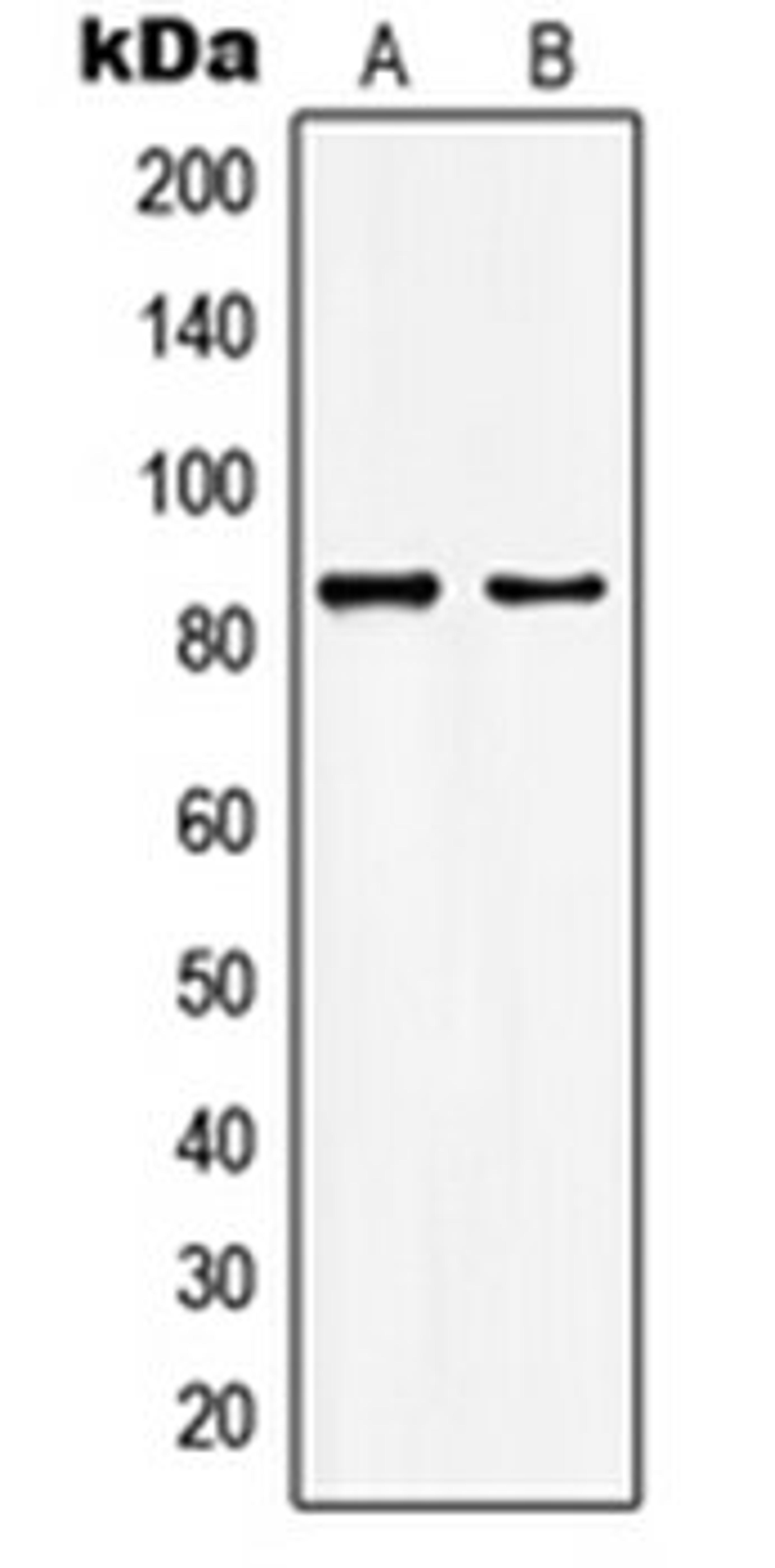 Western blot analysis of HepG2 (Lane 1), MCF7 (Lane 2) whole cell lysates using KAT7 antibody