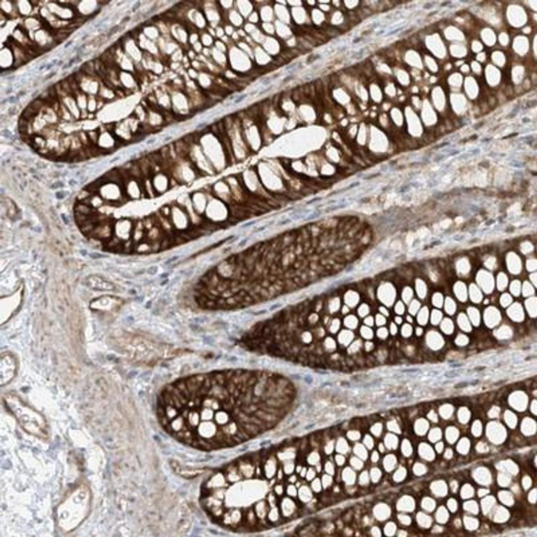 Immunohistochemistry: IL1F5 Antibody [NBP1-83894] - Staining of human colon shows strong cytoplasmic positivity in glandular cells.