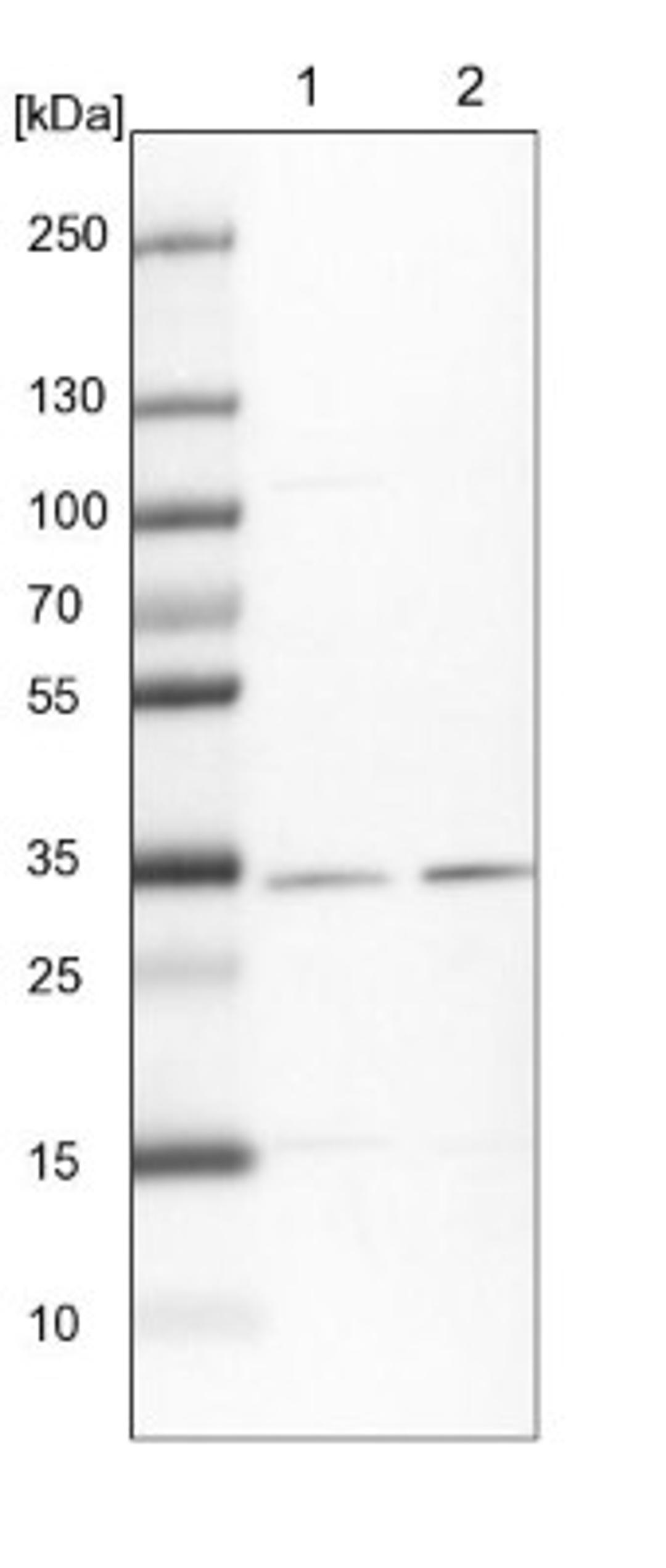 Western Blot: HCCS Antibody [NBP1-86577] - Lane 1: NIH-3T3 cell lysate (Mouse embryonic fibroblast cells)<br/>Lane 2: NBT-II cell lysate (Rat Wistar bladder tumour cells)