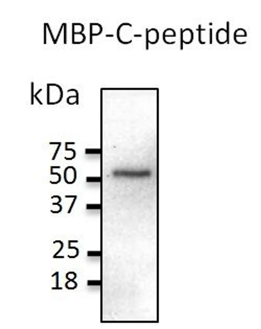 WB analysis of 20 ng of recombinant protein per lane using C-peptide antibody