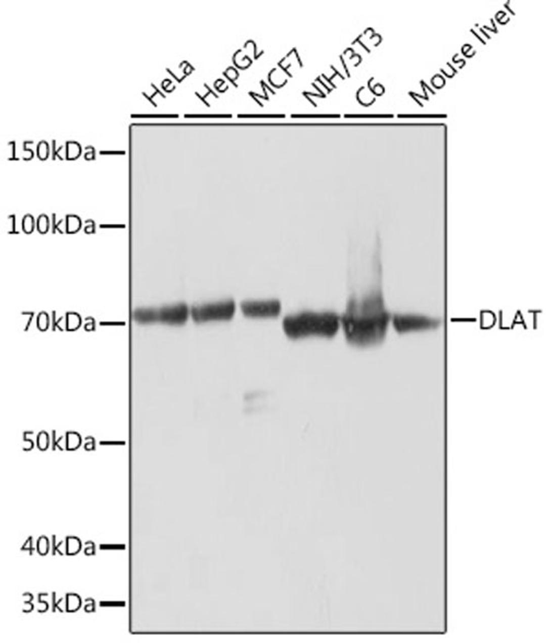 Western blot - DLAT Rabbit mAb (A8814)