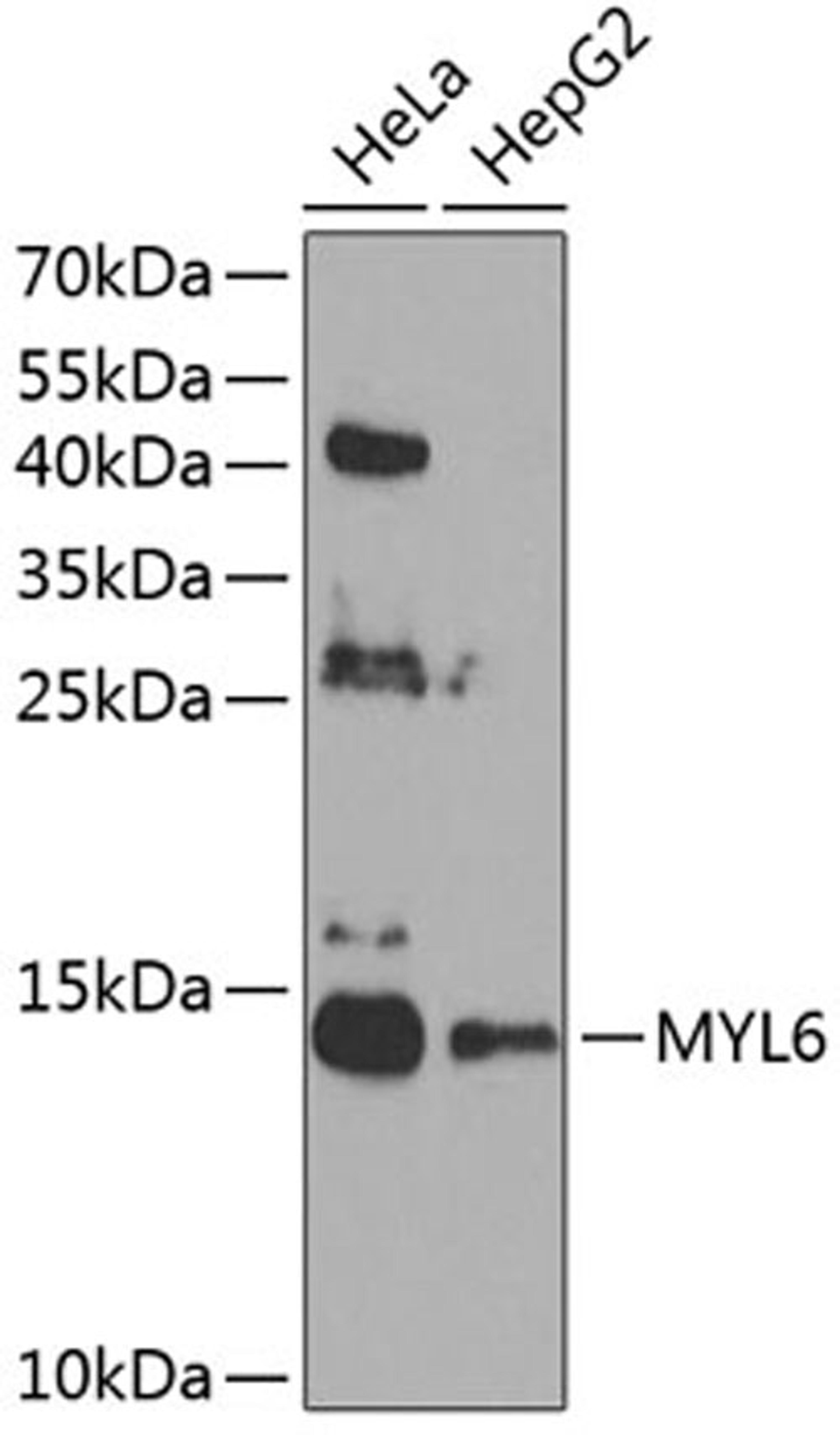 Western blot - MYL6 antibody (A8557)