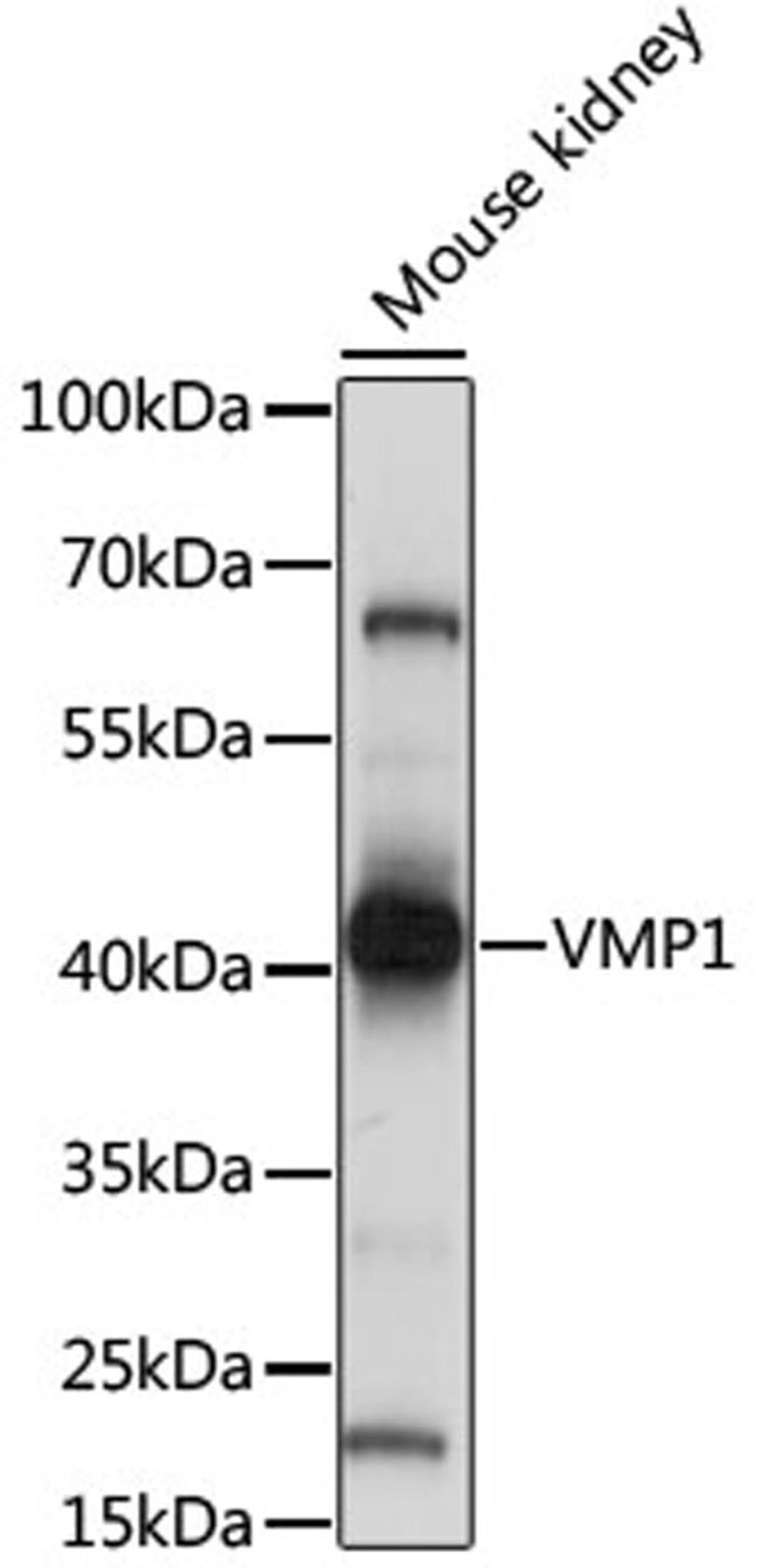 Western blot - VMP1 antibody (A15523)