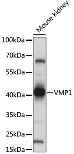 Western blot - VMP1 antibody (A15523)