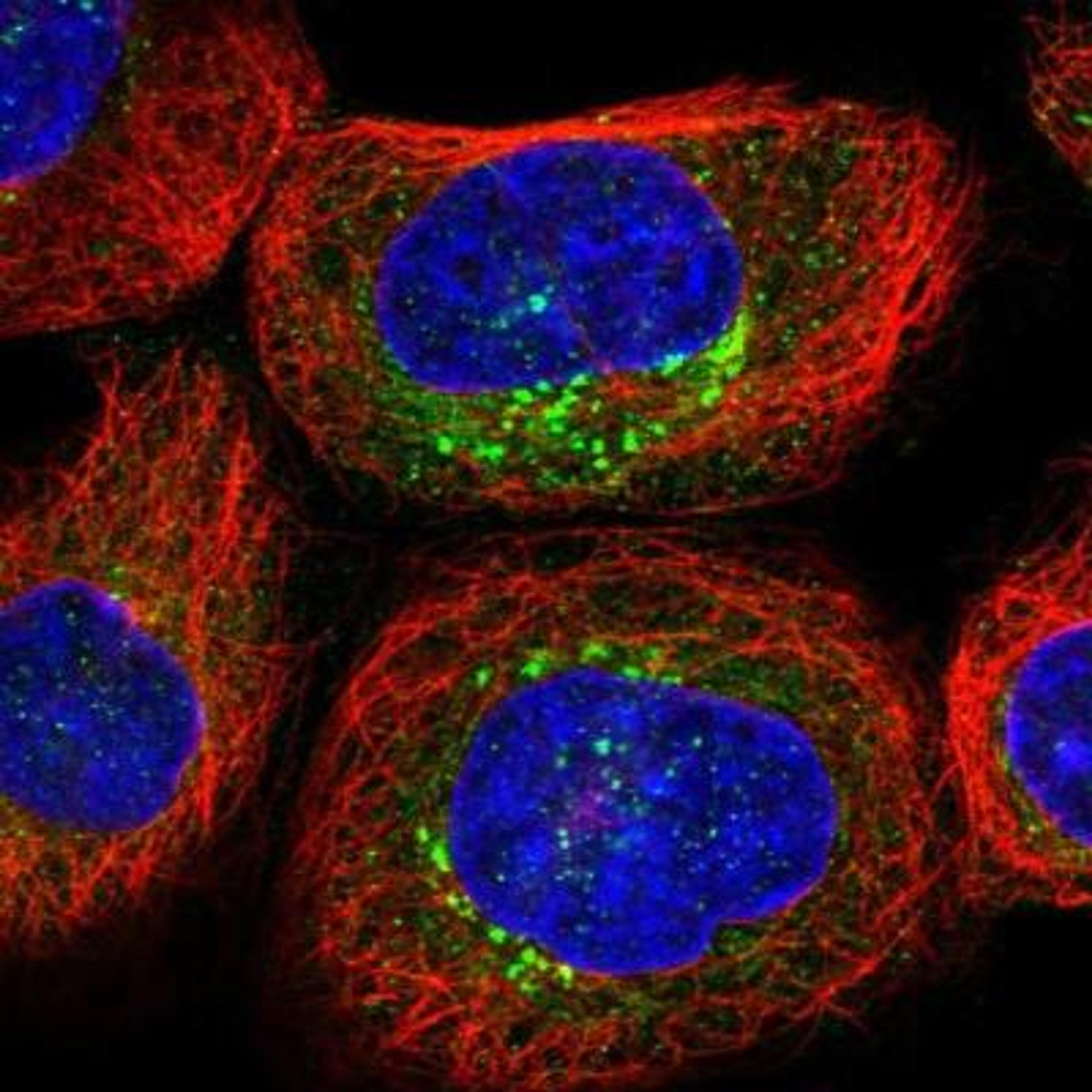 Immunofluorescence: ACCN4 Antibody [NBP1-88860] - Staining of human cell line A-431 shows positivity in golgi apparatus.