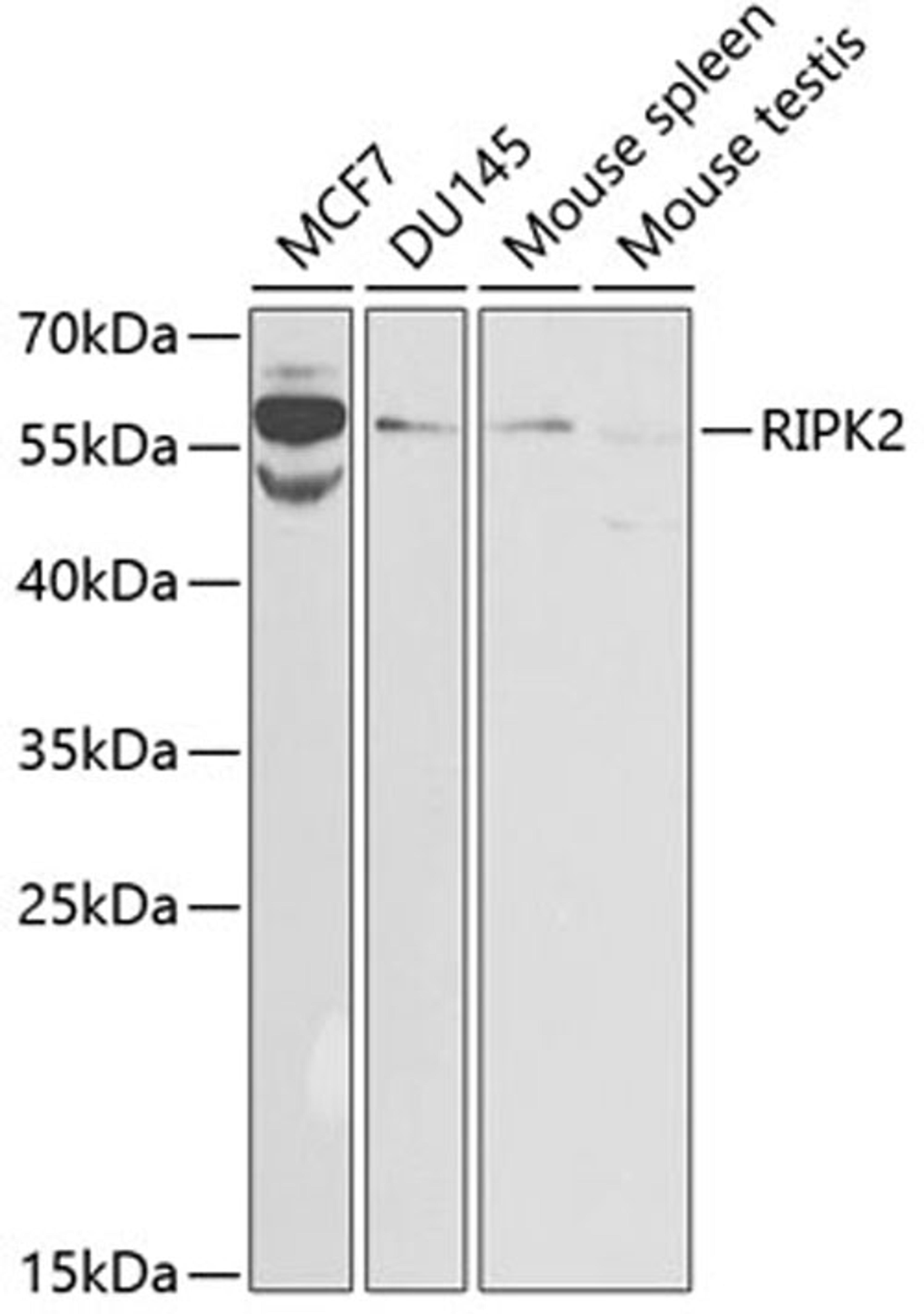 Western blot - RIPK2 antibody (A2498)