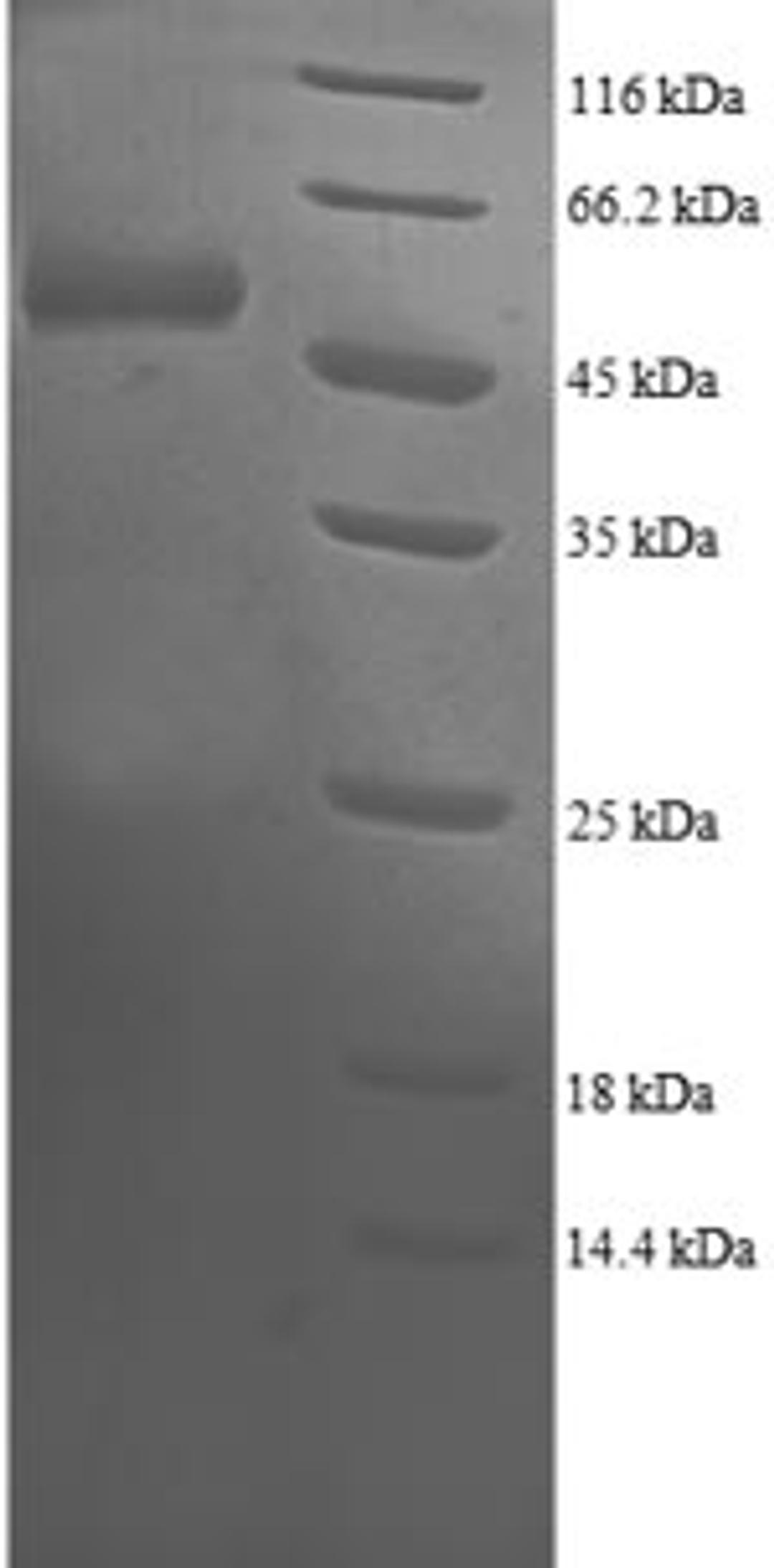(Tris-Glycine gel) Discontinuous SDS-PAGE (reduced) with 5% enrichment gel and 15% separation gel.