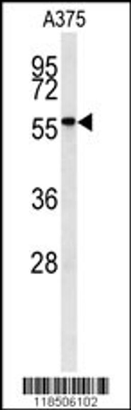 Western blot analysis of NAB2 antibody in A375 cell line lysates (35ug/lane)