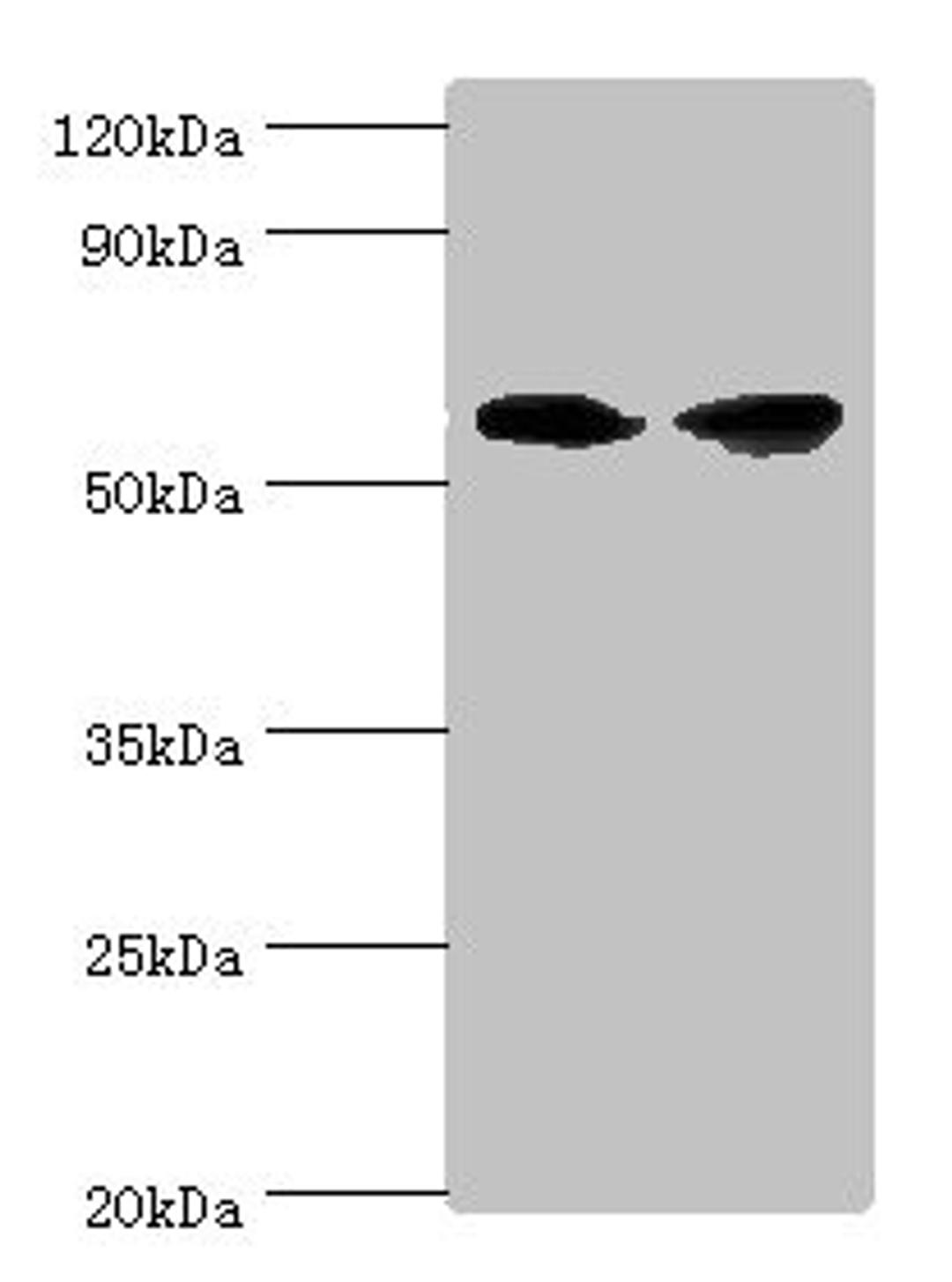 Western blot. All lanes: AHCYL1 antibody at 12ug/ml. Lane 1: Hela whole cell lysate. Lane 2: 293T whole cell lysate. Secondary. Goat polyclonal to rabbit IgG at 1/10000 dilution. Predicted band size: 59, 54 kDa. Observed band size: 59 kDa. 