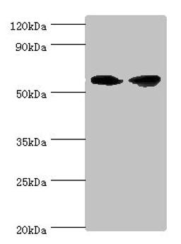 Western blot. All lanes: AHCYL1 antibody at 12ug/ml. Lane 1: Hela whole cell lysate. Lane 2: 293T whole cell lysate. Secondary. Goat polyclonal to rabbit IgG at 1/10000 dilution. Predicted band size: 59, 54 kDa. Observed band size: 59 kDa. 