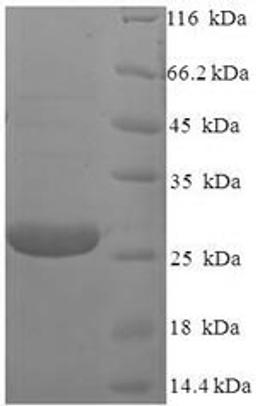 (Tris-Glycine gel) Discontinuous SDS-PAGE (reduced) with 5% enrichment gel and 15% separation gel.