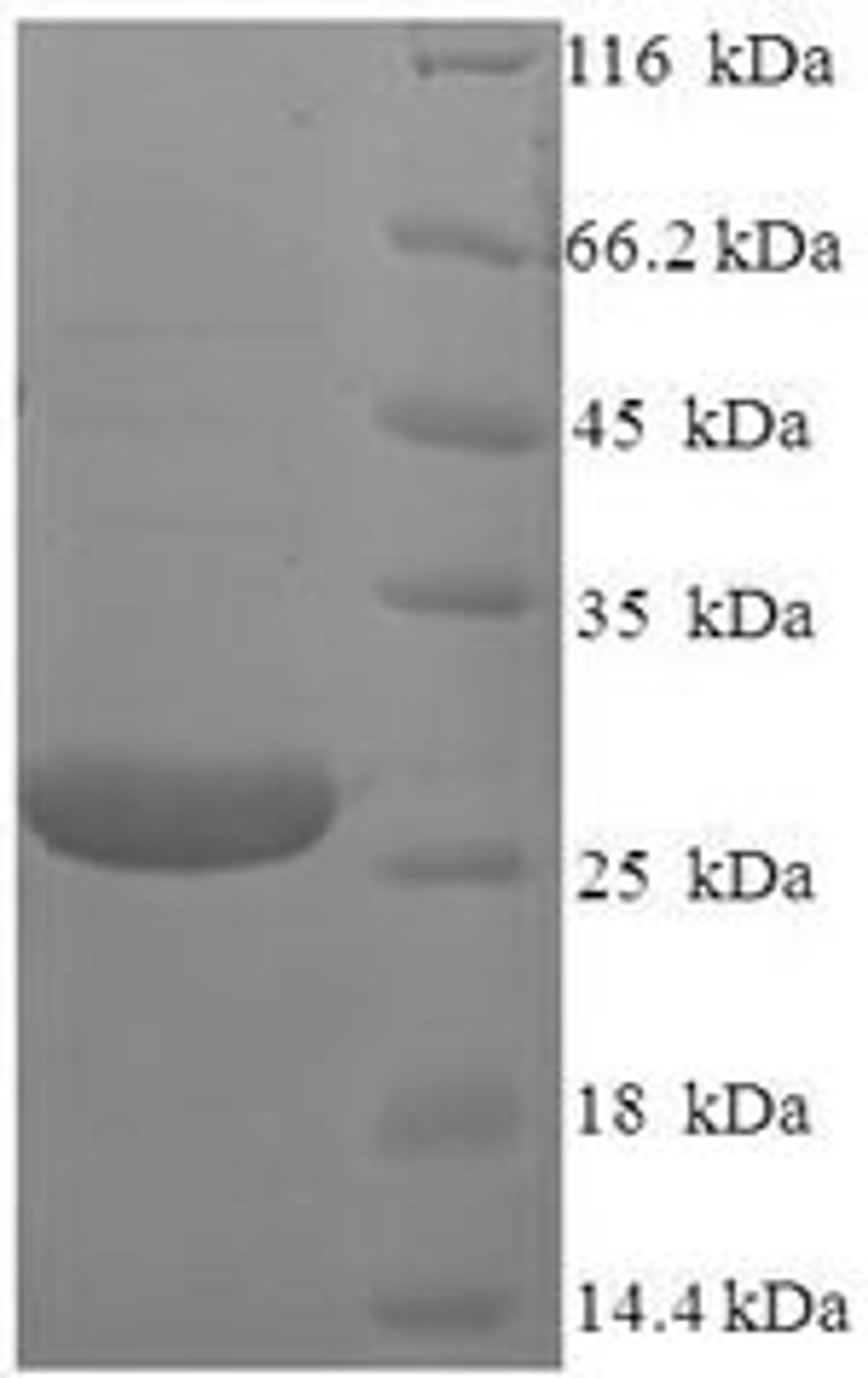 (Tris-Glycine gel) Discontinuous SDS-PAGE (reduced) with 5% enrichment gel and 15% separation gel.