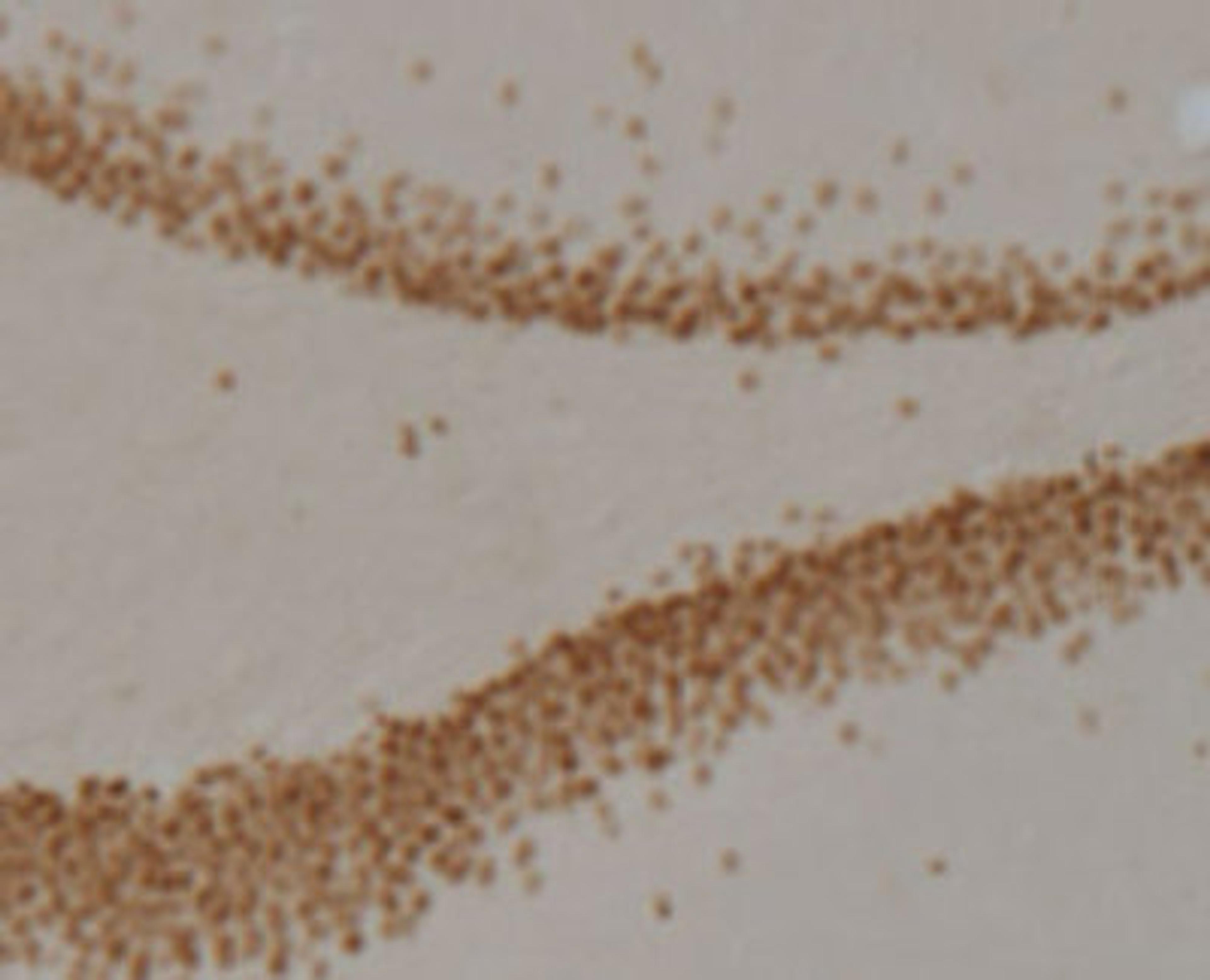 Immunohistochemistry: PROX1 Antibody (5G10) [NBP1-30045] - Rat dentate gyrus showing specific immunolabeling of the prox1 protein. Photo courtesy of Justin Kievits and Teresa Milner, Weill Cornell Medical College.