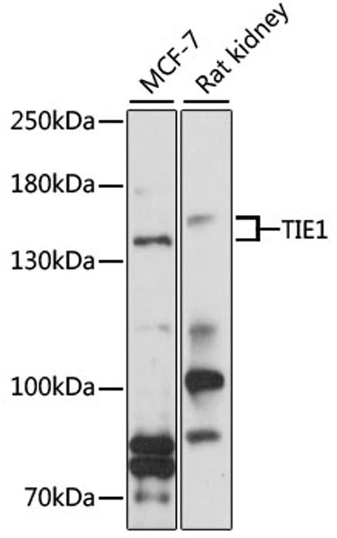 Western blot - TIE1 antibody (A3334)