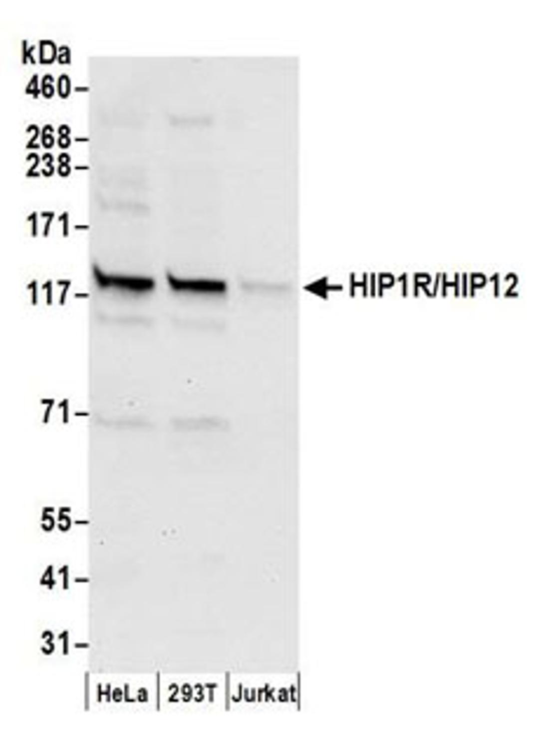 Detection of human HIP1R/HIP12 by western blot.