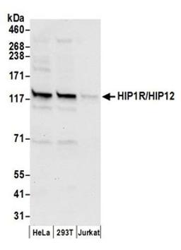 Detection of human HIP1R/HIP12 by western blot.