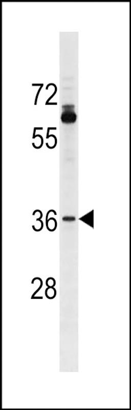 Western blot analysis in A375 cell line lysates (35ug/lane).