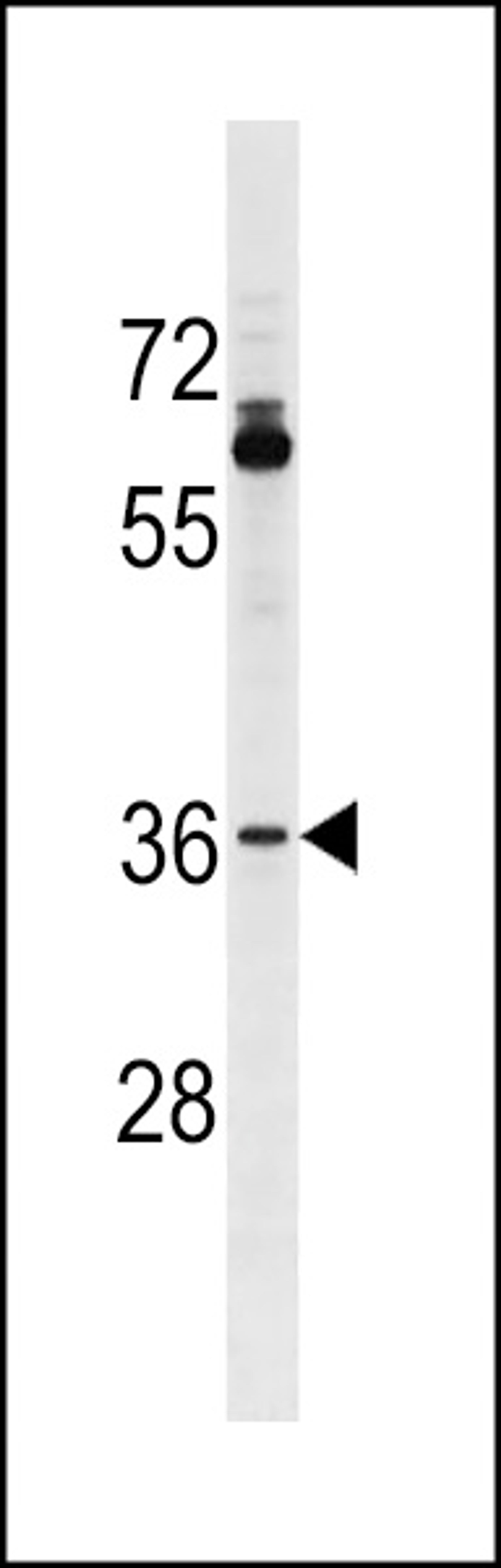 Western blot analysis in A375 cell line lysates (35ug/lane).