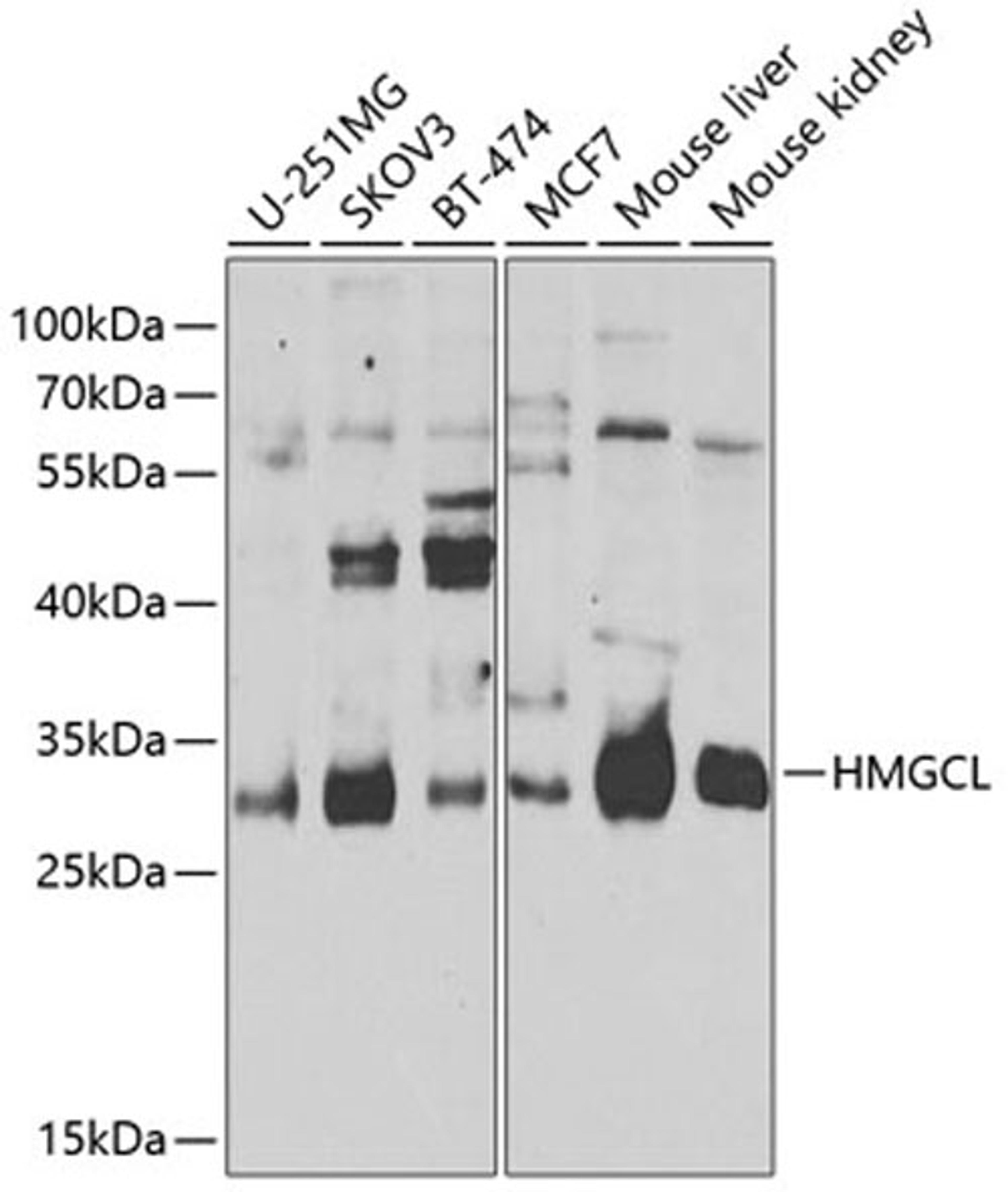 Western blot - HMGCL antibody (A8052)